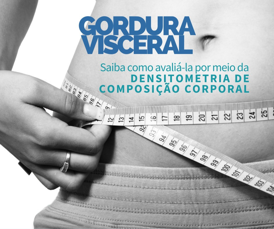 Avaliação da Gordura Visceral (ou Tecido Adiposo Visceral – TAV) por meio da Densitometria de Composição Corporal